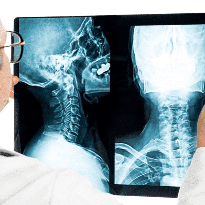 precio-o-costo-de-cirugia-con-el-mejor-medico-cirujano-oncologo-cerca-de-colonia-centro
